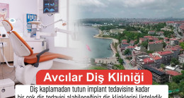 Avcılar Diş Kaplama Fiyatları Ne Kadar