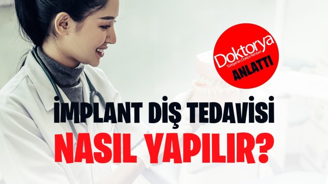 İmplant Diş Tedavisi Nasıl Yapılır?