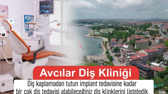 Avcılar Diş Kaplama Fiyatları Ne Kadar